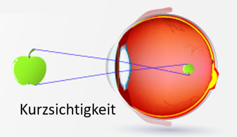 Wie funktioniert das Auge?